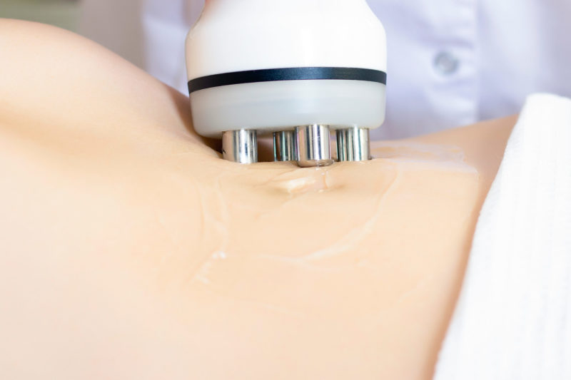 Cavitación ultrasónica en un salón de belleza, una mujer recibe terapia anticelulitis y antigrasa.